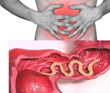 Ανθρώπινα παράσιτα