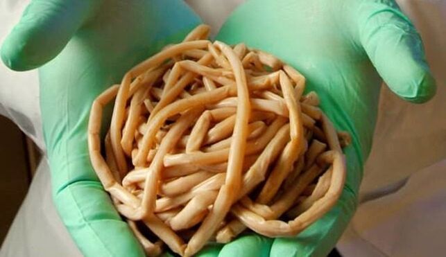 απομάκρυνση παρασίτων από το σώμα